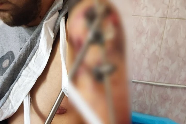 Ветеран із Харкова відкрив власне виробництво одягу після важкого поранення